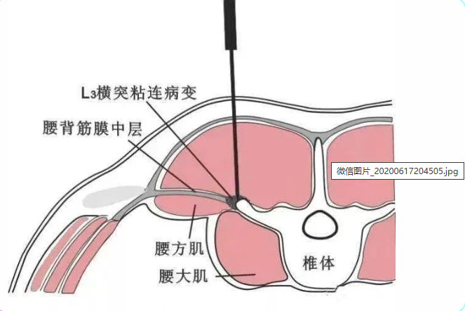微信图片_20200617204505.jpg 图片