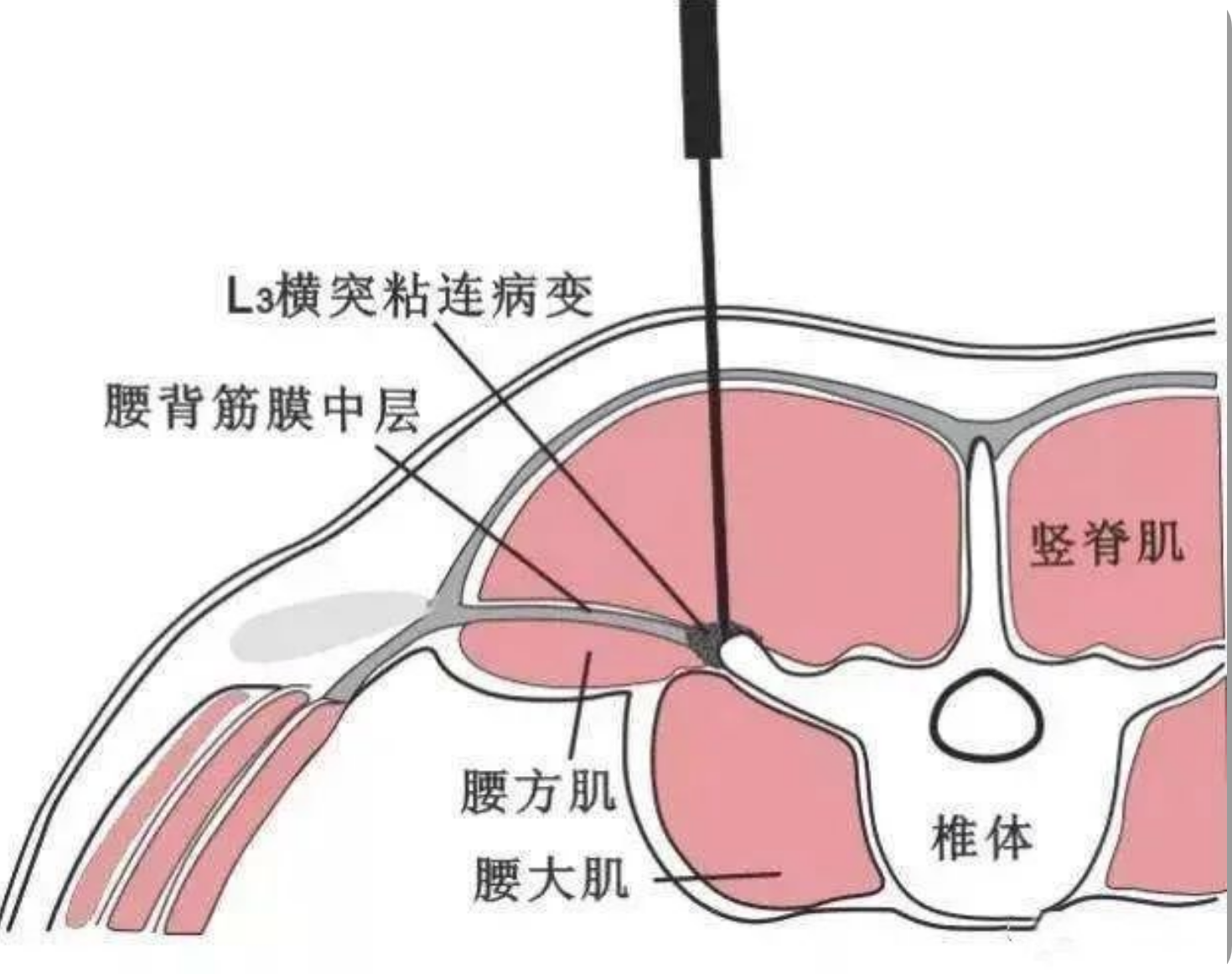 微信图片_20200617204505.jpg 图片