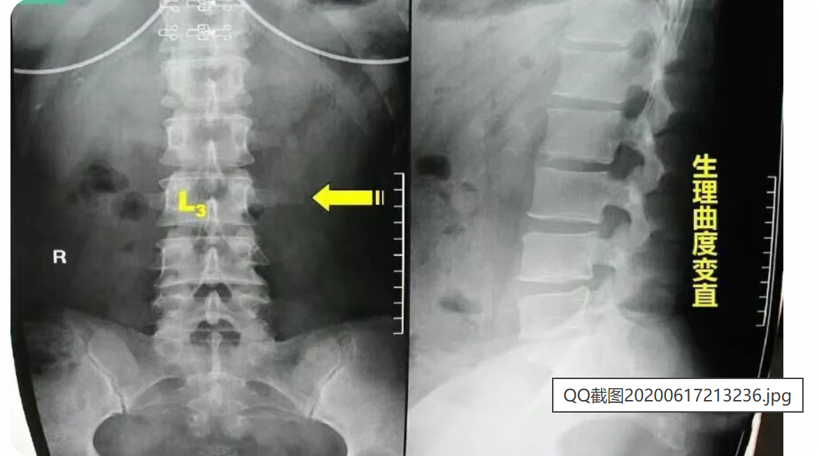 QQ截图20200617213236.jpg 图片